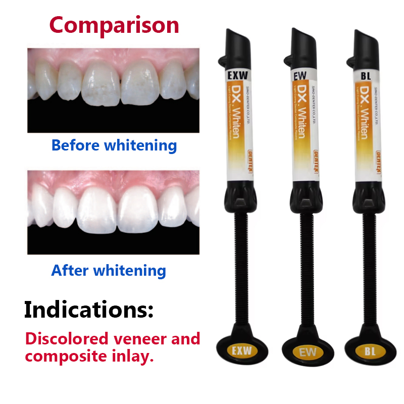 Enamel Light Curing Dental Com - Lighting Jockey のレビューと価格
